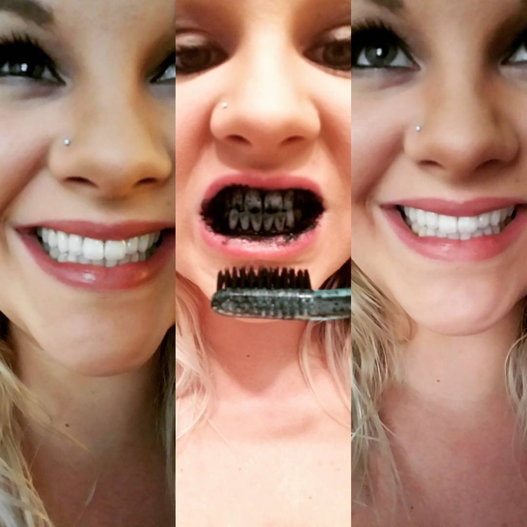 Charcoal Powder Teeth Whitening Kit