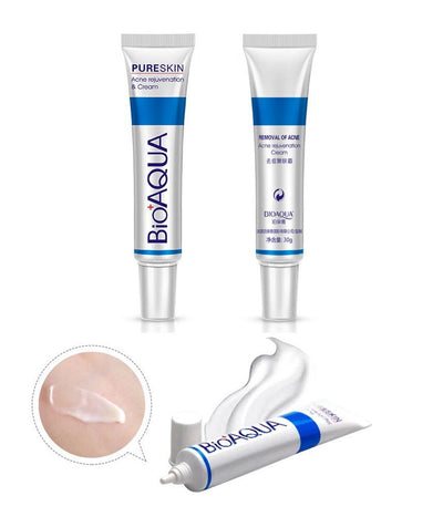 Bioaqua Acne/Scar Cream 3-Pack